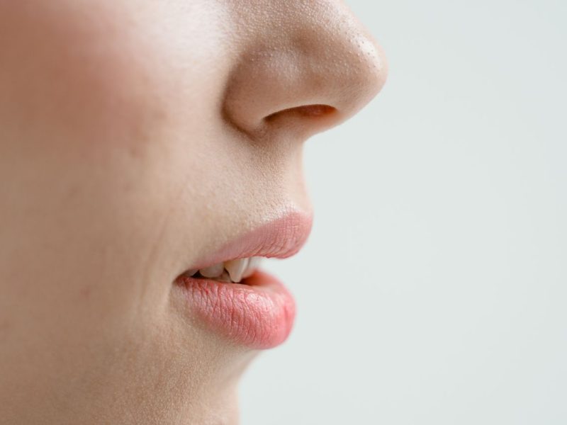 Kosmetyki dermatologiczne na trądzik i AZS: czym różnią się od drogeryjnych kremów i kiedy warto po nie sięgnąć